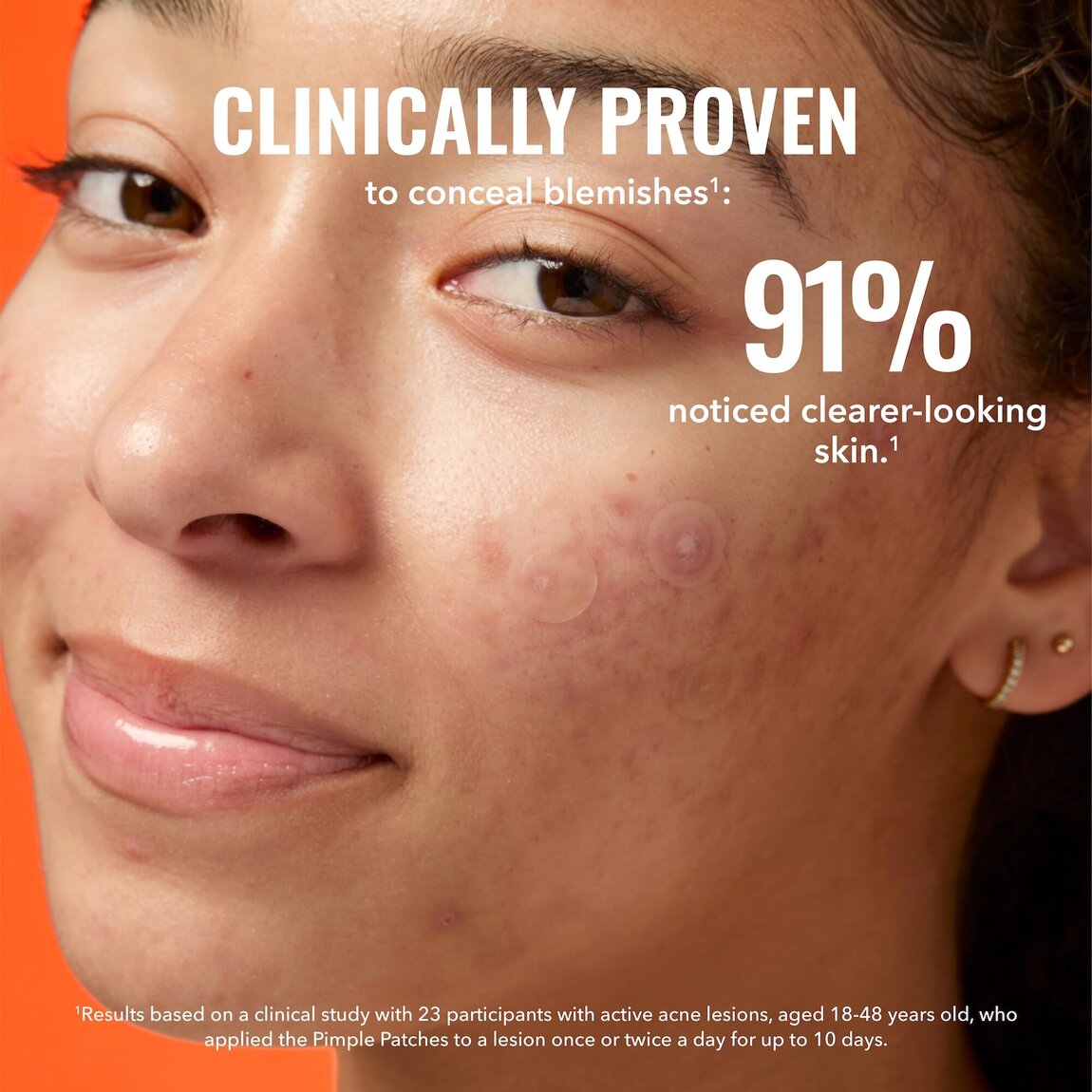 pimple-patches-k7 zb_p.jpg